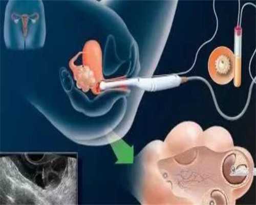 试管婴儿医保政策解析与辅助生育新趋势